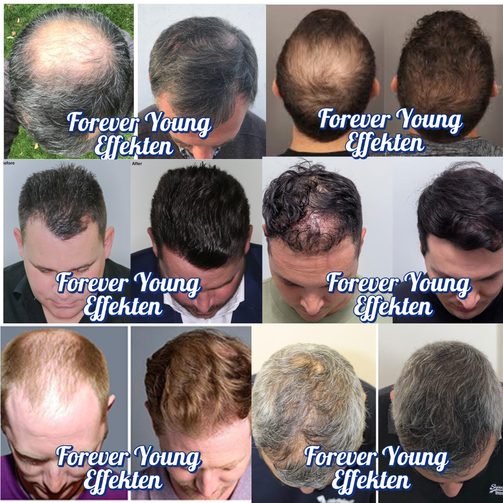 Forever Young -  Hair Growth Formula